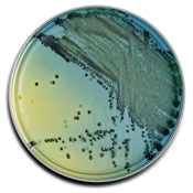 Prepared Plated Media: Mueller Hinton Agar with 5% Sheep Blood