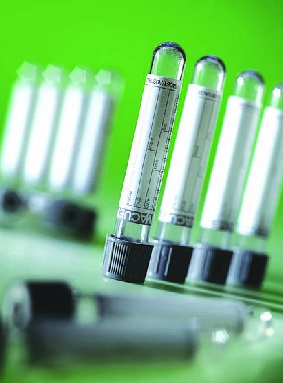 Vacuette Gray Top, 5.5 mL