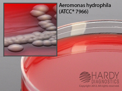Blood Agar w/Ampicillin