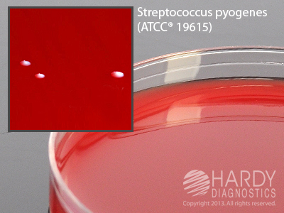 Blood Agar 10%