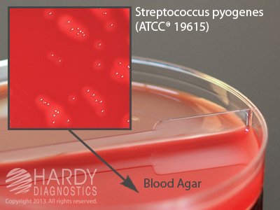 Blood Agar, 5%/Chocolate With Bacitracin <B>(MINIMUM ORDER: 20 packs)