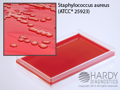 Blood Agar 5%, 30mL<br><b>MINIMUM ORDER: 10 packs