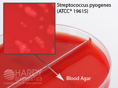 Blood Agar, 5%/Blood Agar, 5%