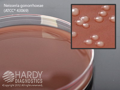 Chocolate Agar