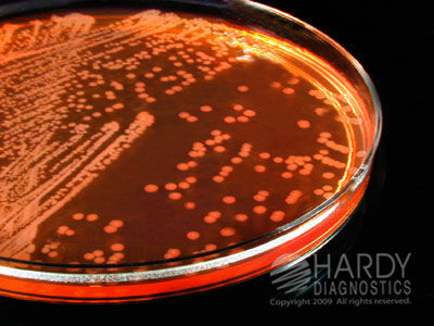 CT-SMAC For E. Coli 0157