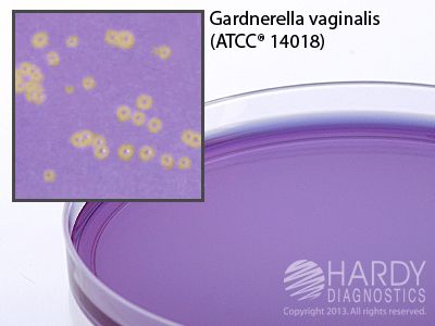 Gardnerella Vaginalis Agar Medix Your On Line Laboratory Supply Shop