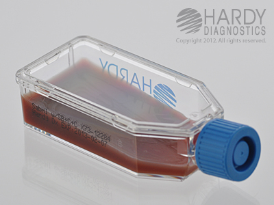 SabHI Agar With Blood, Chloramphenicol & Cycloheximide