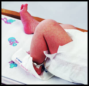 Infant Heel Warmer