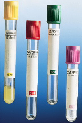 Tube, Plastic (Green Top) w/ Lith. Heparin - 4 mL.