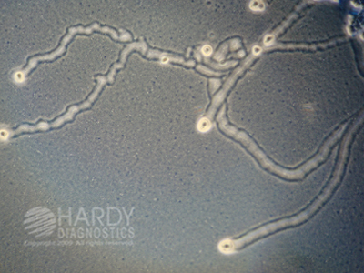 Acanthamoeba Broth