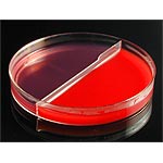 Blood Agar, 5%/MacConkey