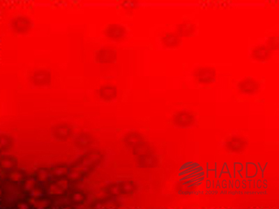 Blood Agar 5%, 45mL
