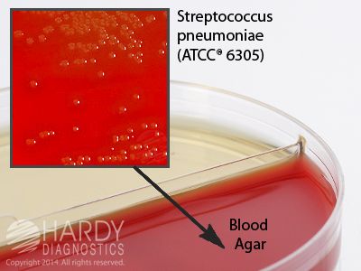 Blood Agar/UTI