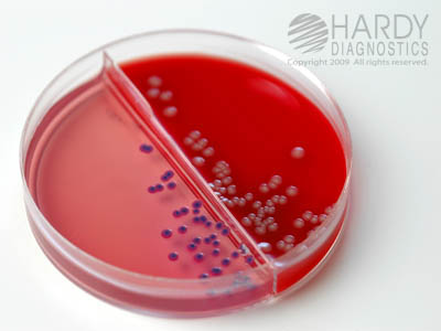 BluEcoli Urine Biplate