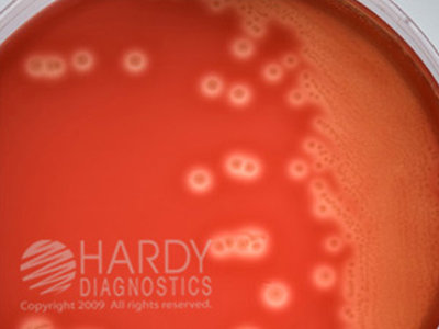 GBS Detect, for non-hemolytic Group B Strep