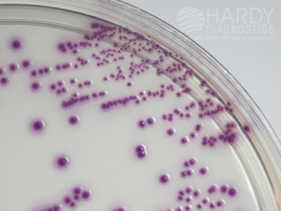 HardyCHROM ECC, for E. coli and coliforms, 15x60mm contact plate