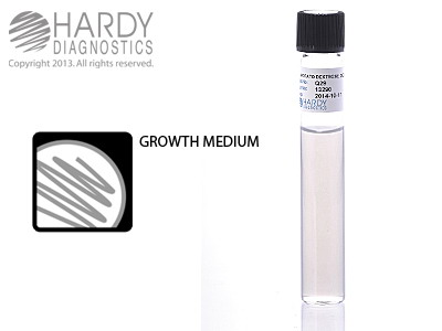 Potato Dextrose Agar Deep