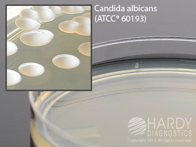 Sabdex Agar