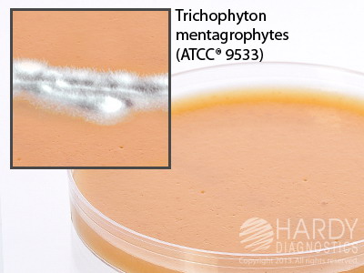V9 Agar