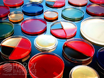 Vibrio Parahaemolyticus Sucrose Agar (VPSA) plate